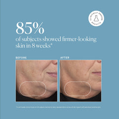 Naturium Retinol Complex Serum ingredients blend—encapsulated retinol and bakuchiol support even tone.