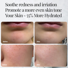 Neclar CICA Aloe Toner Spray applied on face during routine for pre-serum prep.