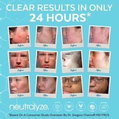 Neutralyze Renewal Complex cream application highlighting lightweight, non-greasy texture for daily use.