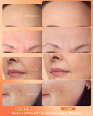 NEWKEY face mask coverage flatlay demonstrates full-face LED exposure.