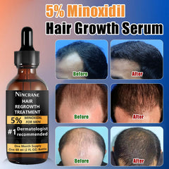 Nincrane Minoxidil 5% dropper for precise beard growth application.