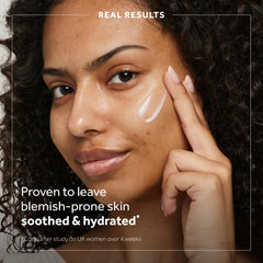 No7 Derm Solutions daily moisturizer texture swirl showing smooth absorption for blemish-prone skin