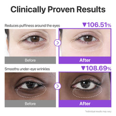 numbuzin No.9 eye patches with peptides caffeine for firming look.