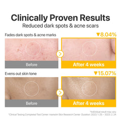Numbuzin No5 essence-packed pad with glutathione and niacinamide for post-cleanse care