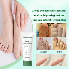 Nutraboost Nail Care Gel application shows soothing moisturizer for healthy nails