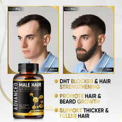 NutraPro men's hairline and crown support image highlights thinning areas