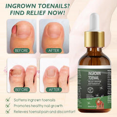 NWAKRD stainless steel tool for at-home toenail care