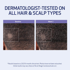 Obagi Nu-Cil BioStim scalp massage scene highlights soothing feel and circulation boost