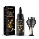 OCSINL Minoxidil bottle with 60ml serum for hair regrowth support.