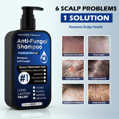 Oely antifungal shampoo lather shows gentle cleansing with natural extracts.