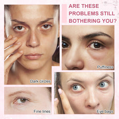 Omplen caffeine eye serum under-eye application demonstrating puffiness reduction potential.