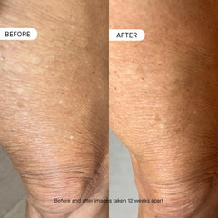 OneSkin BODY OS-01 hydration effect on damp skin promotes lasting moisturization.