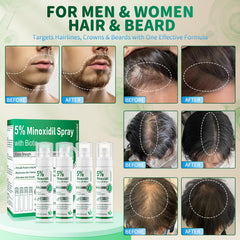 ONIADBA minoxidil application to scalp demonstrates easy daily use.