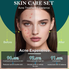 Onkessy eye cream applying gentle hydration to delicate area