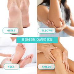 Onyx Professional dry-cracked-feet-treatment balm applied on heel area for smoothing