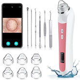 Ottleba blackhead remover vacuum overview in light pink for at home pore care