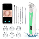 Ottleba pore remover camera view with 1080p live feed and lights for precise observation