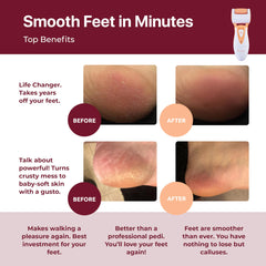 CR900 roller heads offering versatile smoothing for different callus levels