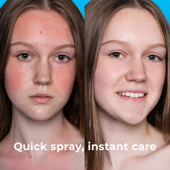 Close-up of PatchRx HOCL spray on skin for calming irritation.