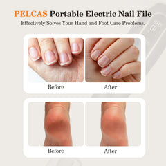 PEL CAS ergonomic nail file kit comfortable grip for long sessions