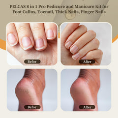 PELCA S nail file with LED light for accurate filing during manicures.