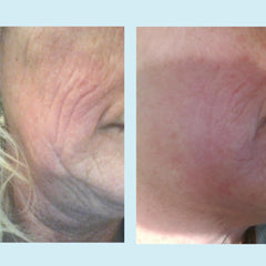 Perfect Image Lactic 50% Gel Peel gel spread on hand showing texture and consistency
