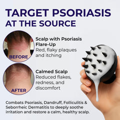 Pharmlitalia Flakes Shampoo label closeup highlights antifungal ingredients for scalp care.