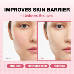 PHYSIOGEL redness-reducing cream tube dispense demonstrates easy application for dry, irritated skin.