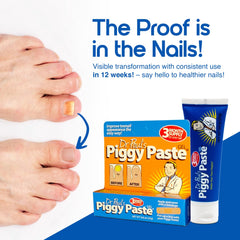 Piggy Paste Gel application dispense closeup emphasizes quick, precise topical use.