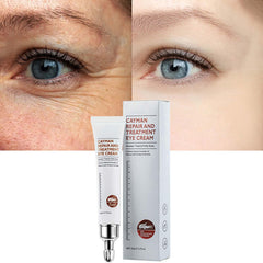 Pinnoocy Magic Eye Cream tube closeup highlighting hydrating, brightening formula for delicate eye skin