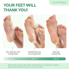 PLANTIFIQUE Foot Peel Mask Peach feet soaking scene to soften dry skin before peeling.