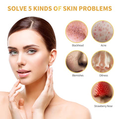 POP MODERN.C 4pc blackhead tools kit laid out for pore care