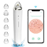 Prabensei blackhead remover camera 20x magnification captures pores for precise treatment.