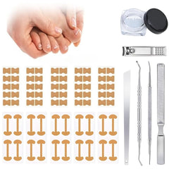 Professional Pedicure Tools Ingrown Toenail Treatment Kit with breathable corrector strips improving wear comfort.