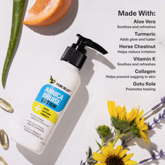 Pure Relief Arnica Cream 4oz bottle ready for daily application after injury.