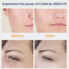 PureYou DermatiPrem mushroom wand designed for broad-area treatment and comfortable skin contact.