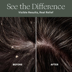 Purist Dandruff Spray close-up label highlights aloe vera and botanicals.