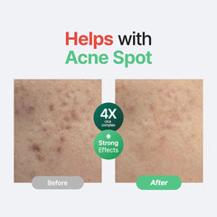 PURITO Centella Unscented Serum on-skin application, soothing after sun or irritation.