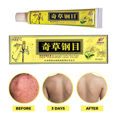 QICAOGANGMU herbal ingredients closeup highlights natural botanicals for soothing skin