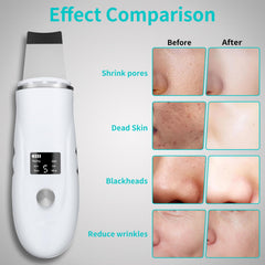 QYCSL face scrubber spatula 3D curve eases tricky contours
