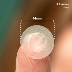 Rael pimple patches applied on skin for early-stage blemish coverage.