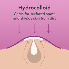 Rael patch applied on skin demonstrates discreet thin coverage overnight.