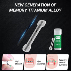 Reieset ingrown toenail removal kit with tools for symptom relief and upkeep.