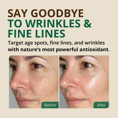RejuveNaturals Vitamin E Oil on skin—soothing hydration for a refreshed look.