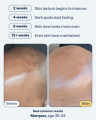 Remedy Science encapsulated-retinol close-up highlights targetting existing spots.