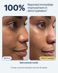 Display of Remedy Science moisturizer ingredients highlighting hydration benefits.