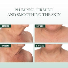 RéVive Fermitif-texture-closeup reveals creamy texture for hydration and smooth skin.