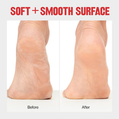 Revlon Callus Remover no-mess catcher shown collecting filings after filing.