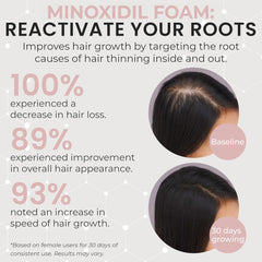 Rida Minoxidil 3-month supply packaging shows unscented, dermatologist-recommended formula.