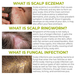Rida Hair Research Institute Folliculitis scalp application demonstrating soothing relief potential
